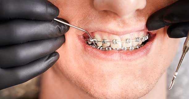 Fixed / Removable Orthodontics